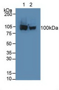 Polyclonal Antibody to Aconitase 1 (ACO1)