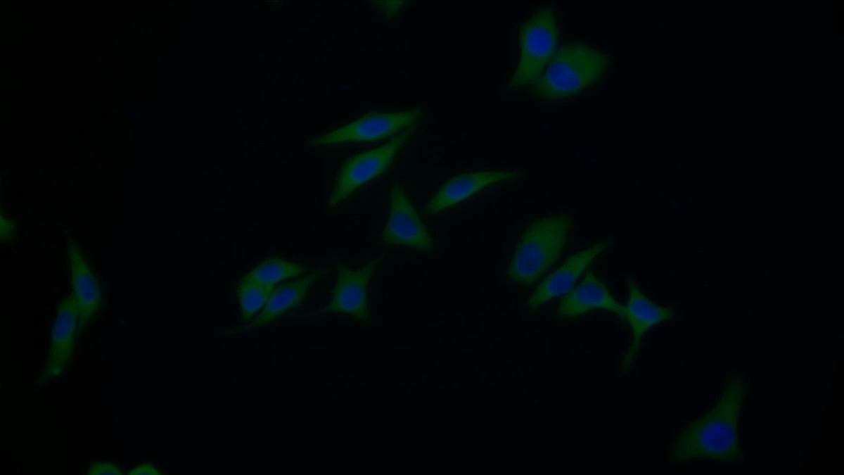 Polyclonal Antibody to Aconitase 1 (ACO1)