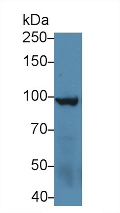 Polyclonal Antibody to Aconitase 1 (ACO1)