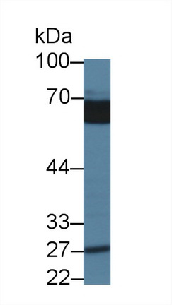 Polyclonal Antibody to Abl Interactor 1 (ABI1)