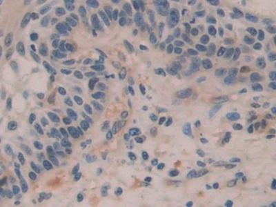 Polyclonal Antibody to H2A Histone Family, Member Y (H2AFY)