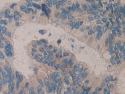 Polyclonal Antibody to H2A Histone Family, Member Y (H2AFY)