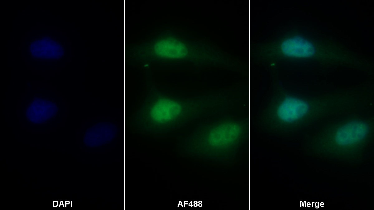 Polyclonal Antibody to Ets Variant 5 (ETV5)