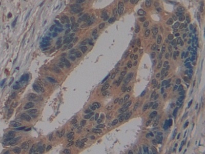 Polyclonal Antibody to Golgi Glycoprotein 1 (GLG1)