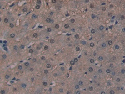 Polyclonal Antibody to Golgi Glycoprotein 1 (GLG1)