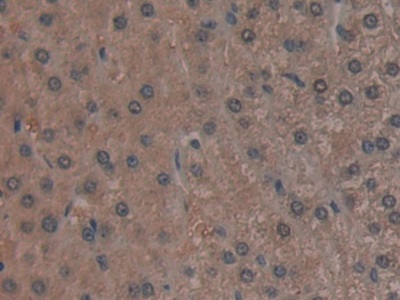 Polyclonal Antibody to Golgi Glycoprotein 1 (GLG1)