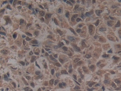 Polyclonal Antibody to Golgi Glycoprotein 1 (GLG1)