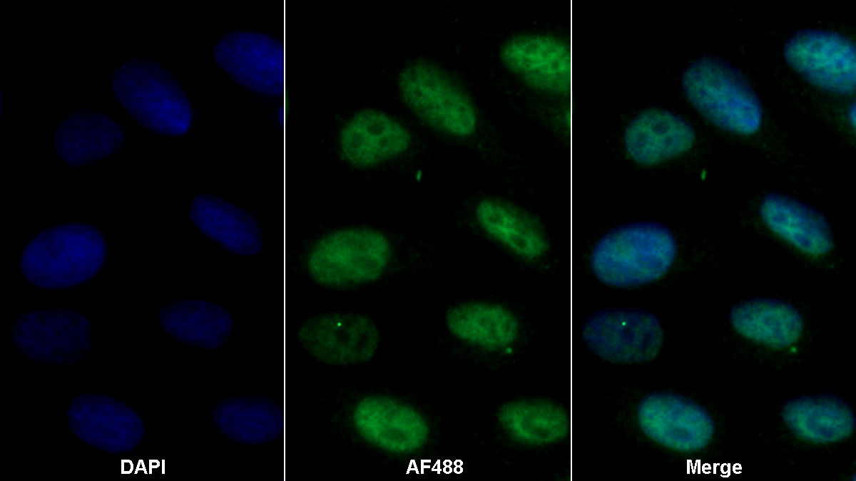 Polyclonal Antibody to MutL Homolog 1 (MLH1)