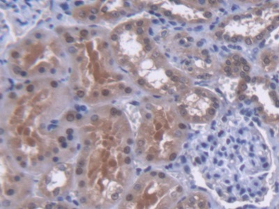 Polyclonal Antibody to MutY Homolog (MUTYH)