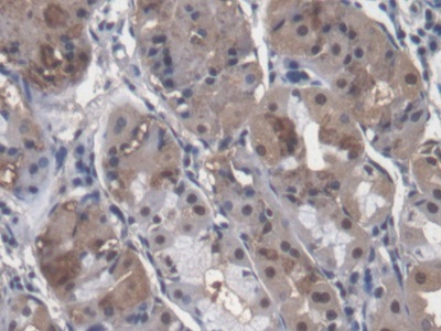 Polyclonal Antibody to MutY Homolog (MUTYH)