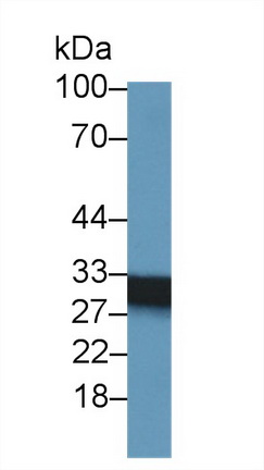 Polyclonal Antibody to Succinate Dehydrogenase Complex Subunit B (SDHB)