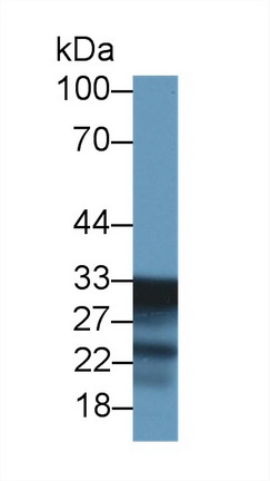 Polyclonal Antibody to Succinate Dehydrogenase Complex Subunit B (SDHB)