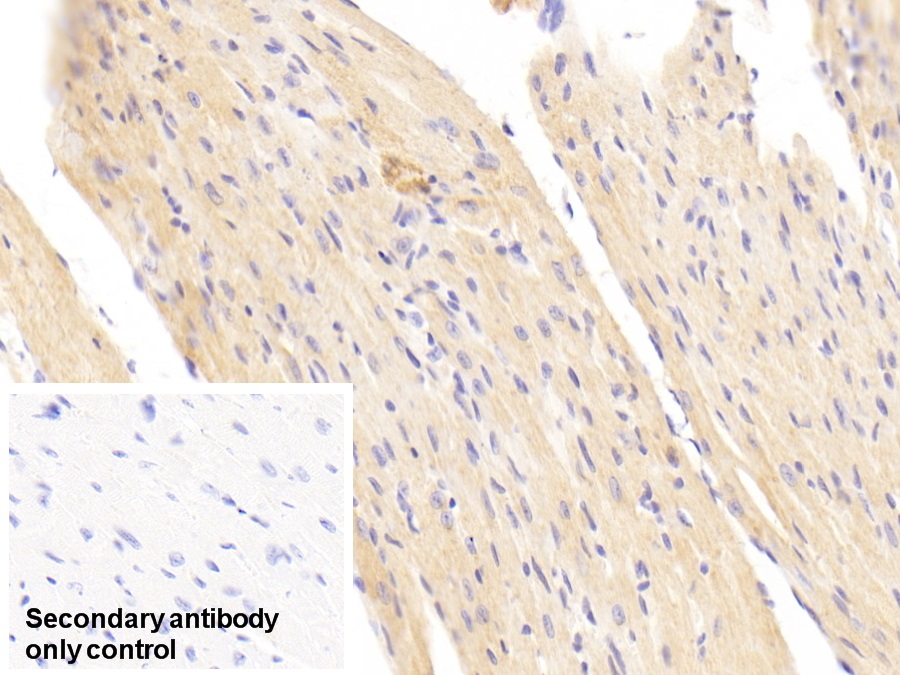 Polyclonal Antibody to Succinate Dehydrogenase Complex Subunit B (SDHB)