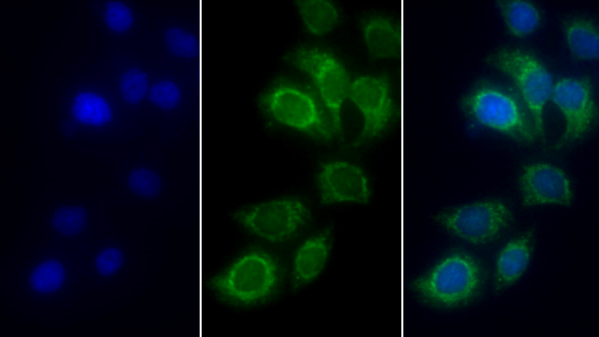 Polyclonal Antibody to Succinate Dehydrogenase Complex Subunit A (SDHA)