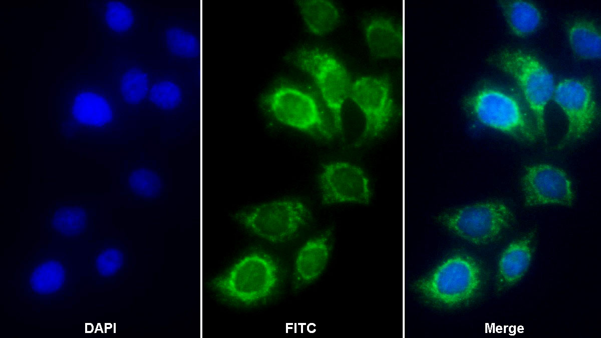 Polyclonal Antibody to Succinate Dehydrogenase Complex Subunit A (SDHA)