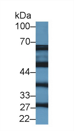 Polyclonal Antibody to Hydroxyacyl Coenzyme A Dehydrogenase Beta (HADHb)