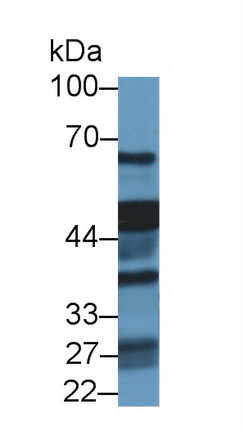 Polyclonal Antibody to Hydroxyacyl Coenzyme A Dehydrogenase Beta (HADHb)