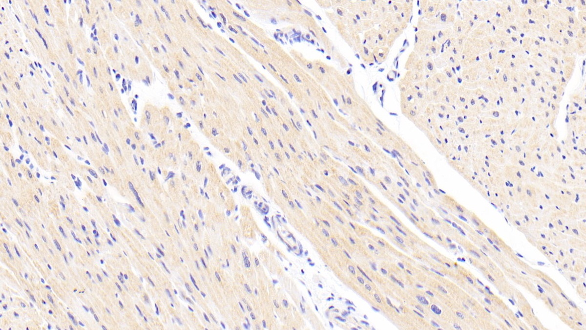 Polyclonal Antibody to NADH Dehydrogenase Ubiquinone Fe-S Protein 1 (NDUFS1)