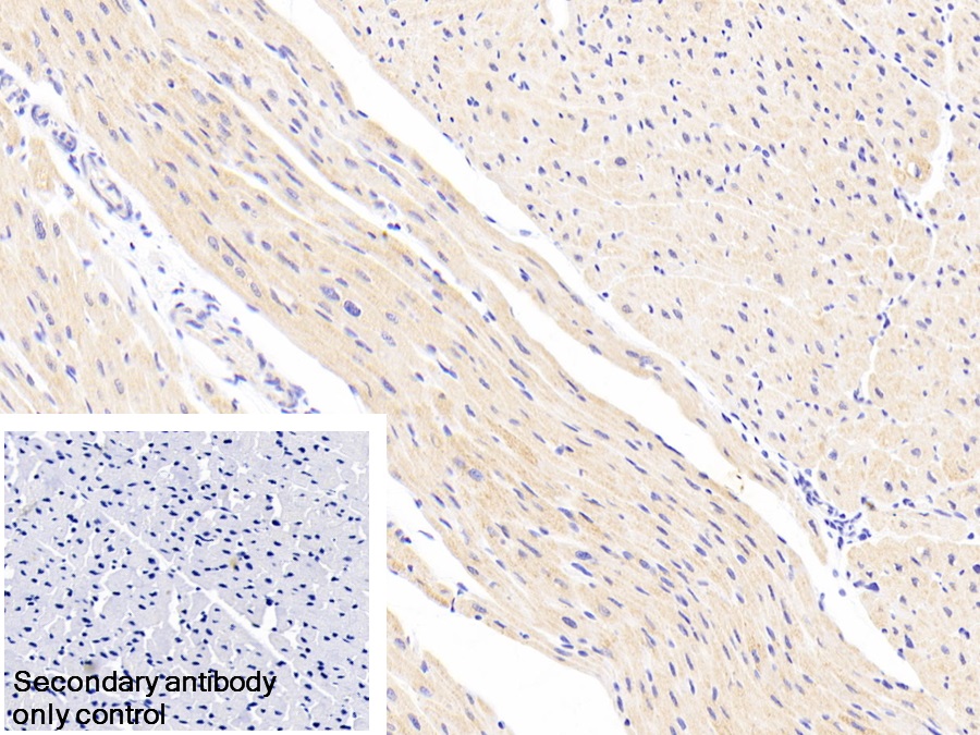 Polyclonal Antibody to NADH Dehydrogenase Ubiquinone Fe-S Protein 1 (NDUFS1)