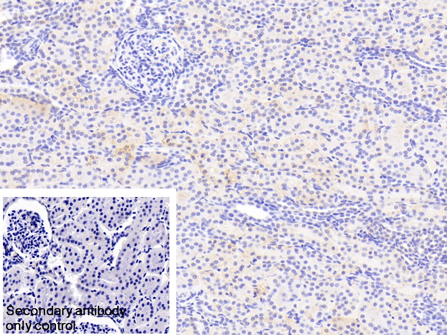 Polyclonal Antibody to NADH Dehydrogenase Ubiquinone Fe-S Protein 1 (NDUFS1)