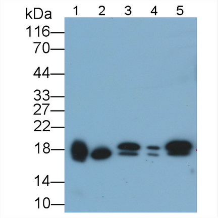 Polyclonal Antibody to Non Metastatic Cells 2, Protein NM23B Expressed In (NME2)