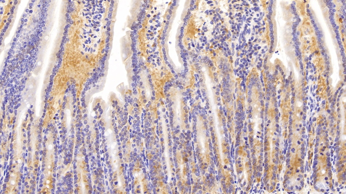 Polyclonal Antibody to Non Metastatic Cells 1, Protein NM23A Expressed In (NME1)