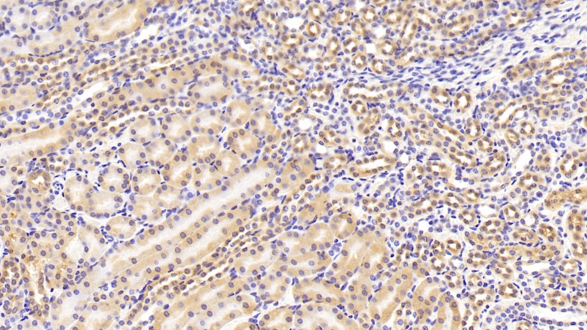 Polyclonal Antibody to Non Metastatic Cells 1, Protein NM23A Expressed In (NME1)