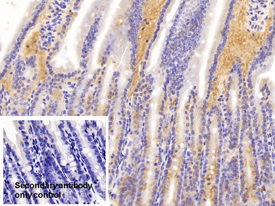 Polyclonal Antibody to Non Metastatic Cells 1, Protein NM23A Expressed In (NME1)