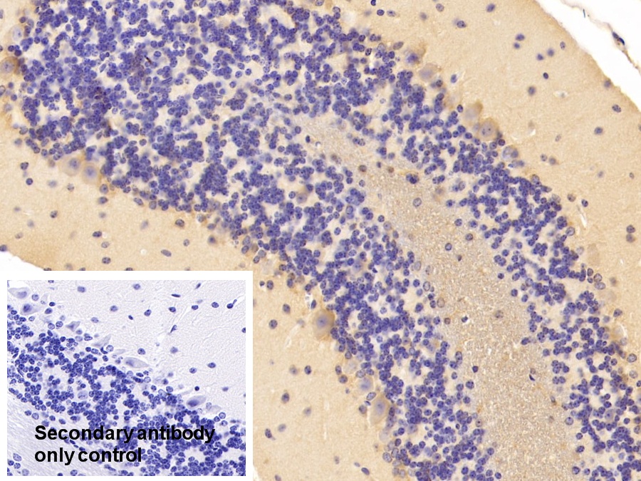 Polyclonal Antibody to Non Metastatic Cells 1, Protein NM23A Expressed In (NME1)