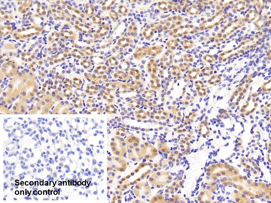 Polyclonal Antibody to Non Metastatic Cells 1, Protein NM23A Expressed In (NME1)