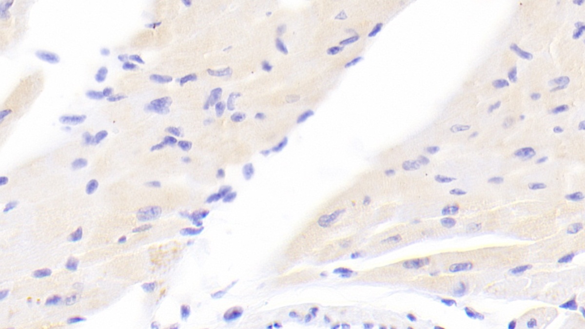 Polyclonal Antibody to Inhibitor Of Kappa-Light Polypeptide Gene Enhancer In B-Cells Kinase Beta (IkBKb)