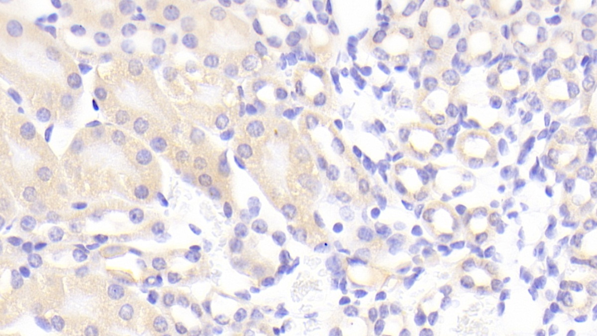 Polyclonal Antibody to Inhibitor Of Kappa-Light Polypeptide Gene Enhancer In B-Cells Kinase Beta (IkBKb)