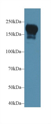 Polyclonal Antibody to Phosphoinositide-3-Kinase Class-2-Beta Polypeptide (PIK3C2b)