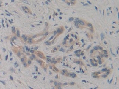 Polyclonal Antibody to Phosphoinositide-3-Kinase Class 3 (PIK3C3)