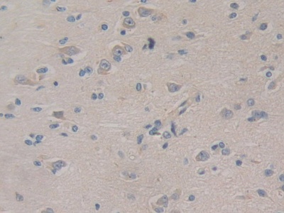 Polyclonal Antibody to Phosphoinositide-3-Kinase Class 3 (PIK3C3)