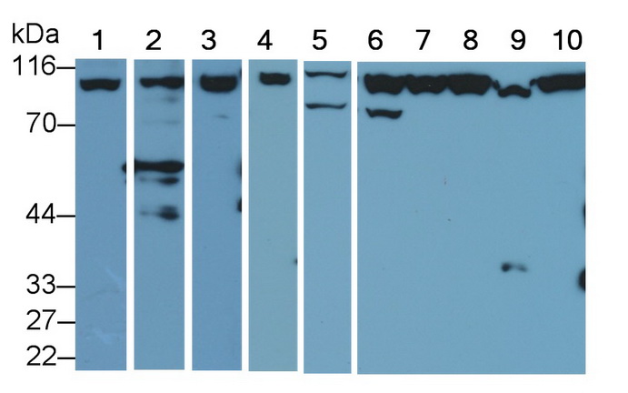 Polyclonal Antibody to Phosphoinositide-3-Kinase Class 3 (PIK3C3)