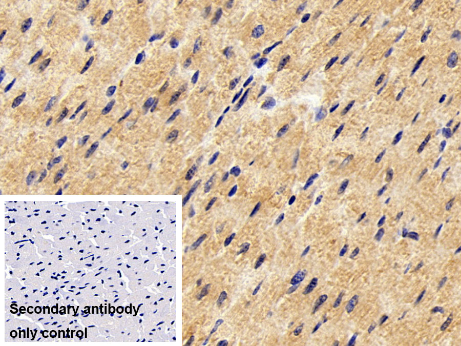 Polyclonal Antibody to Phosphoinositide-3-Kinase Class 3 (PIK3C3)