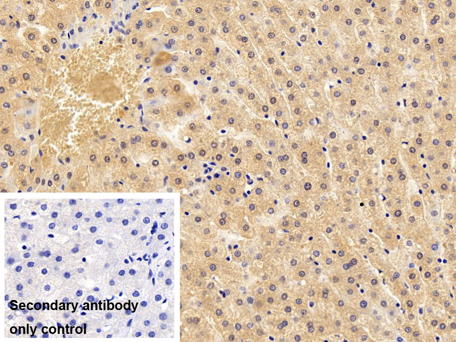 Polyclonal Antibody to Phosphoinositide-3-Kinase Class 3 (PIK3C3)