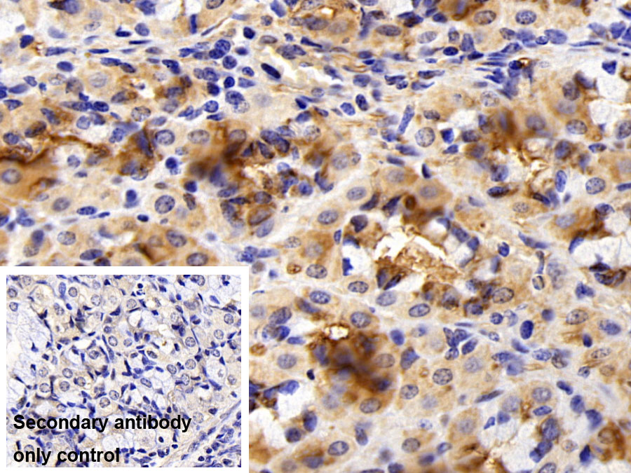 Polyclonal Antibody to Phosphoinositide-3-Kinase Class 3 (PIK3C3)