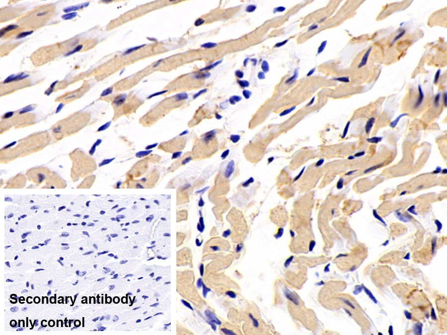 Polyclonal Antibody to Phosphoinositide-3-Kinase Class 3 (PIK3C3)