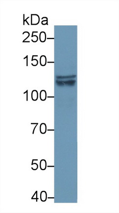 Polyclonal Antibody to Phosphoinositide-3-Kinase Catalytic Beta Polypeptide (PIK3Cb)