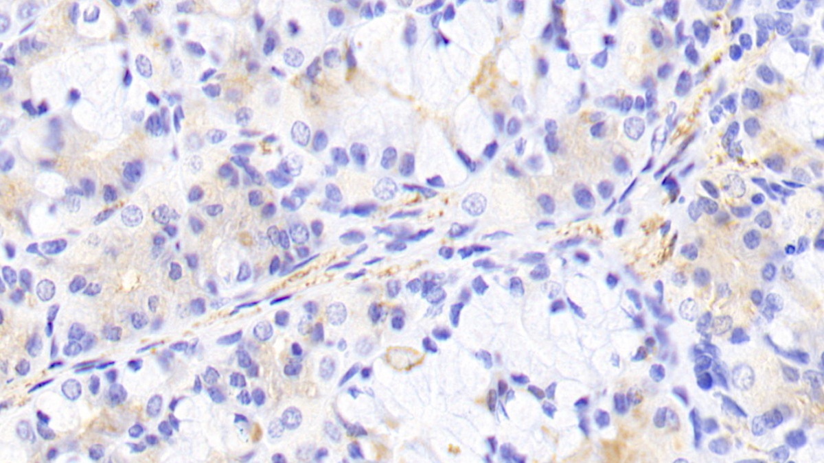 Polyclonal Antibody to Phosphoinositide-3-Kinase Catalytic Beta Polypeptide (PIK3Cb)