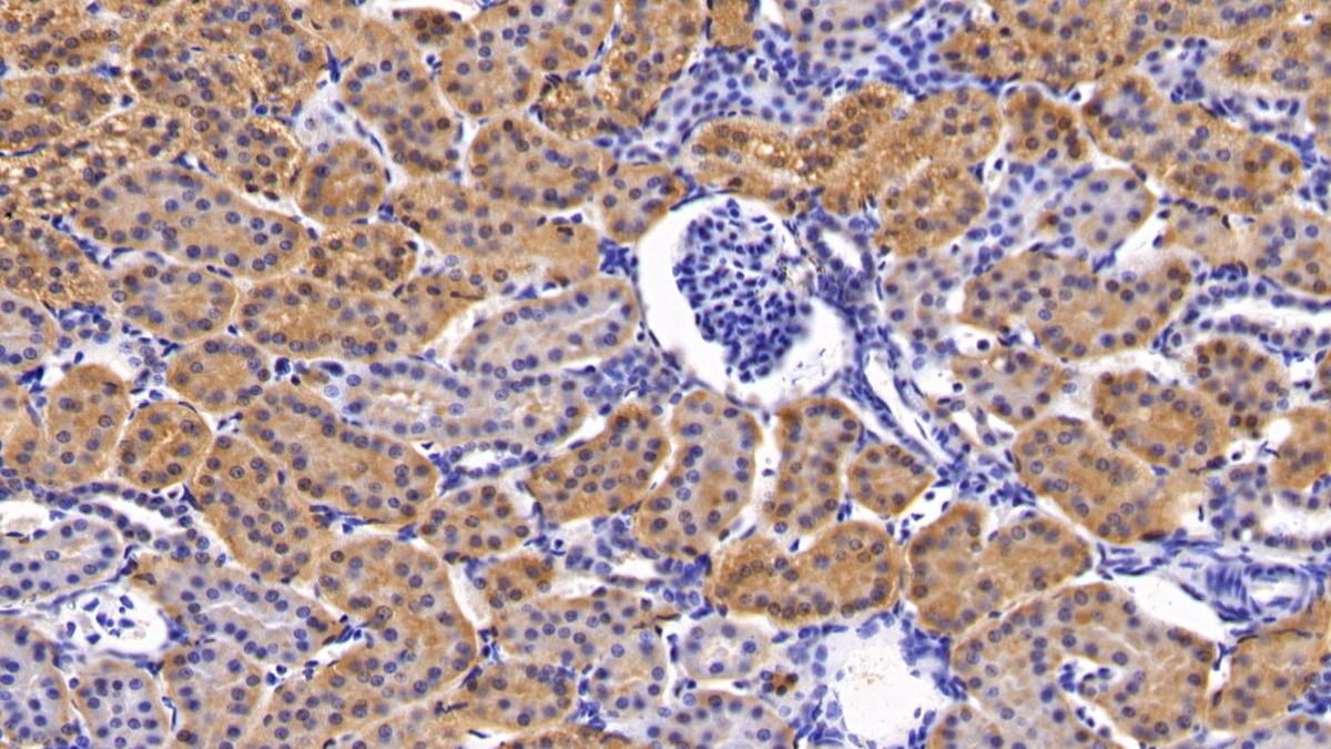 Polyclonal Antibody to Phosphoinositide-3-Kinase Catalytic Beta Polypeptide (PIK3Cb)