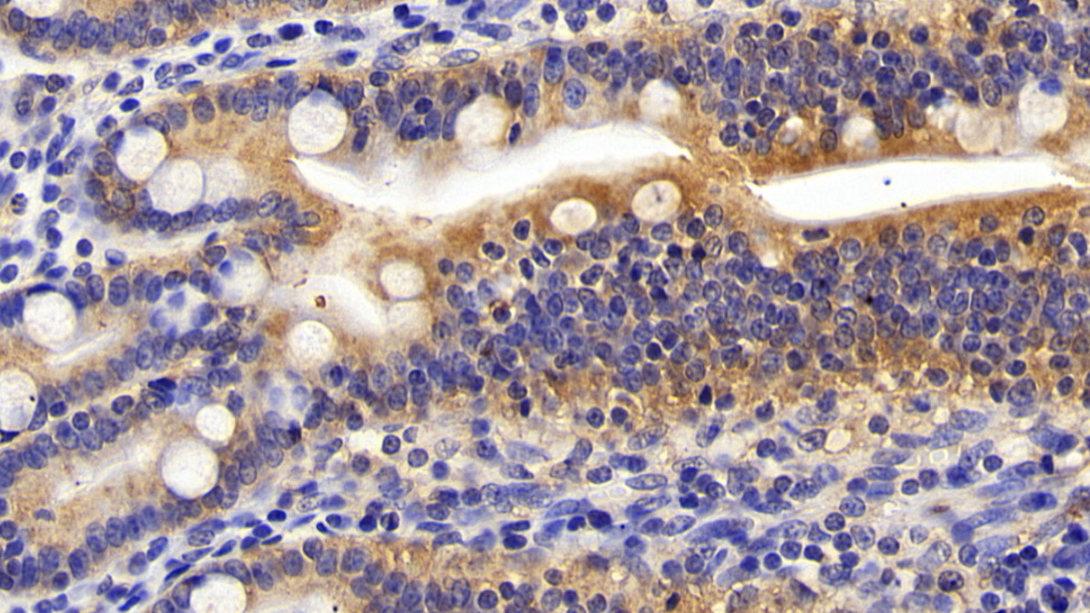 Polyclonal Antibody to Phosphoinositide-3-Kinase Catalytic Beta Polypeptide (PIK3Cb)