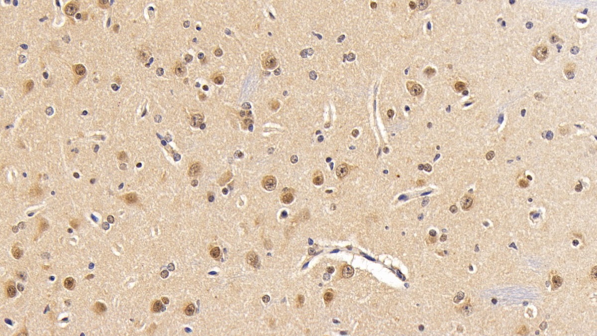 Polyclonal Antibody to Phosphoinositide-3-Kinase Catalytic Beta Polypeptide (PIK3Cb)