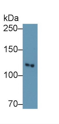 Polyclonal Antibody to Phosphoinositide-3-Kinase Catalytic Beta Polypeptide (PIK3Cb)