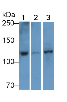 Polyclonal Antibody to Phosphoinositide-3-Kinase Catalytic Beta Polypeptide (PIK3Cb)