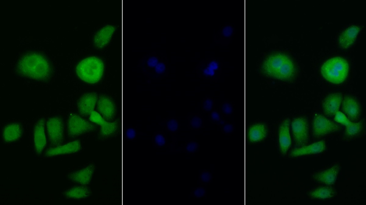 Polyclonal Antibody to Phosphoinositide-3-Kinase Catalytic Beta Polypeptide (PIK3Cb)