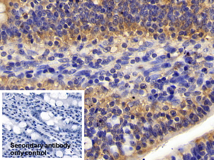 Polyclonal Antibody to Phosphoinositide-3-Kinase Catalytic Beta Polypeptide (PIK3Cb)