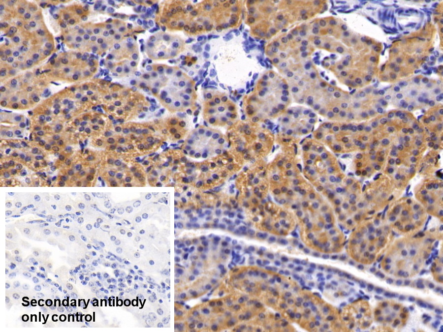 Polyclonal Antibody to Phosphoinositide-3-Kinase Catalytic Beta Polypeptide (PIK3Cb)